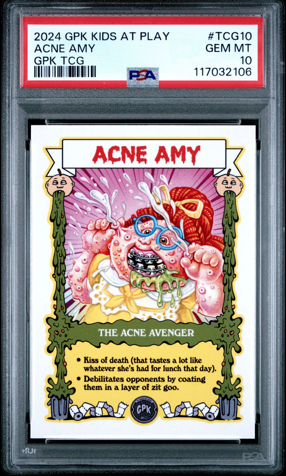 2024 Garbage Pail Kids Kids At Play Gpk Tcg #TCG10 Acne Amy front