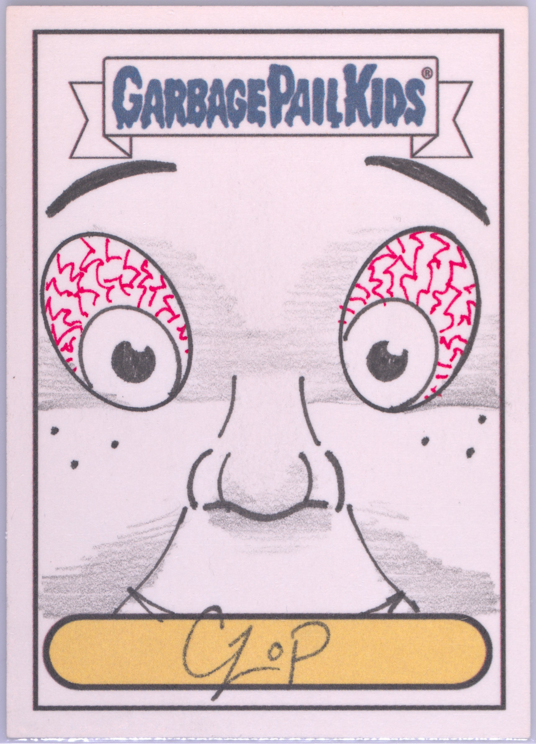 John Czop Boy Face With Bloodshot Eyes