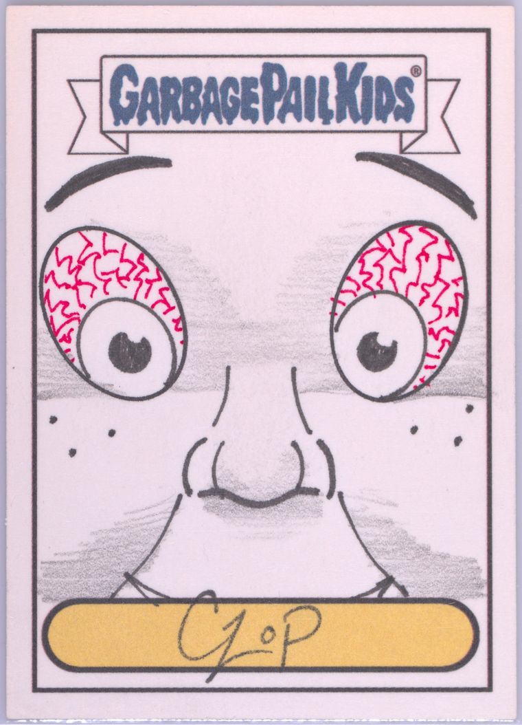 John Czop Boy Face With Bloodshot Eyes