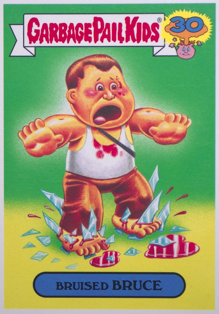 Bruised Bruce