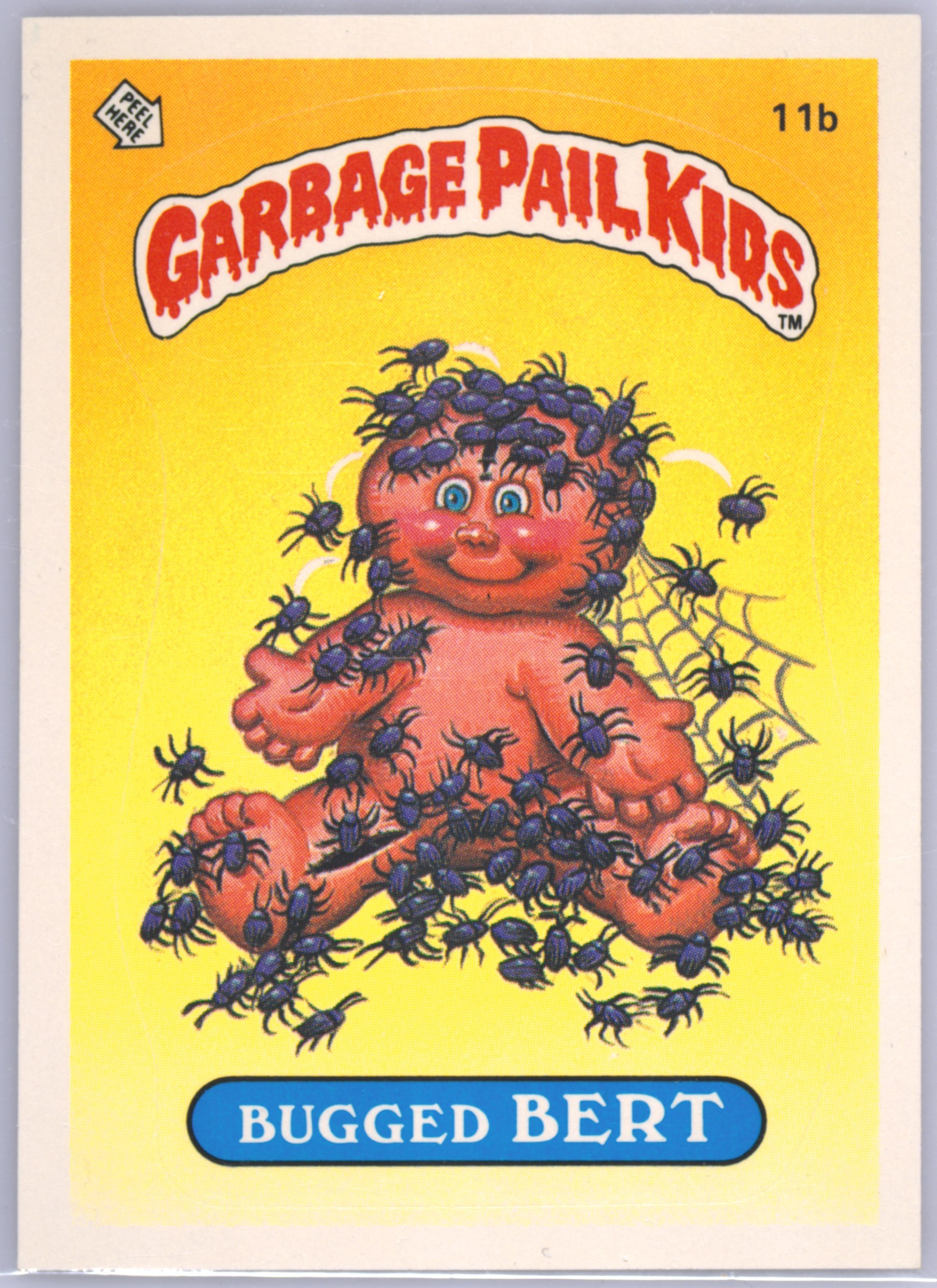 1985 Topps Garbage Pail Kids Original Series 1 #11b Bugged Bert front