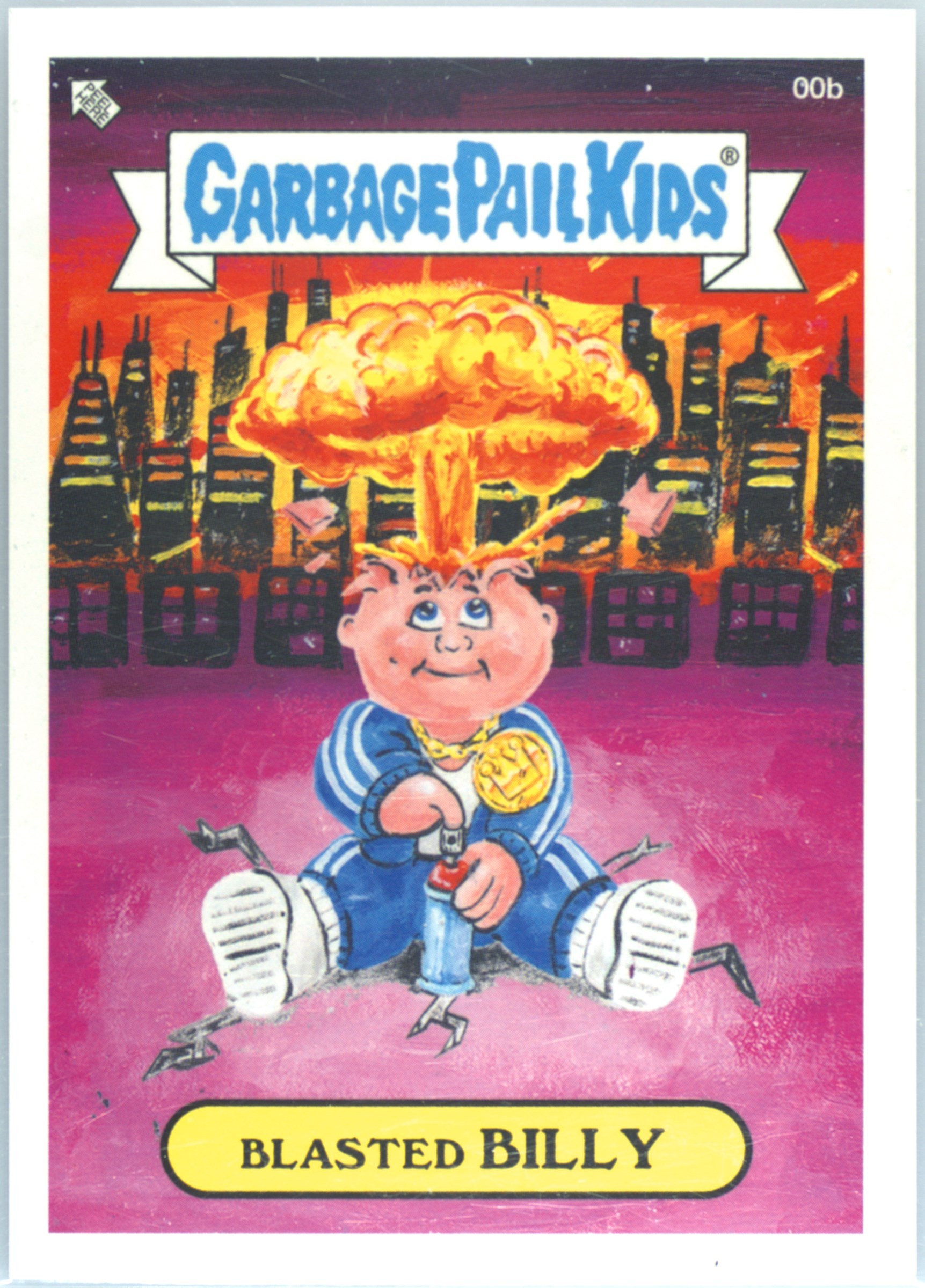 2020 Topps Garbage Pail Kids Beyond The Streets #00b Blasted Billy front